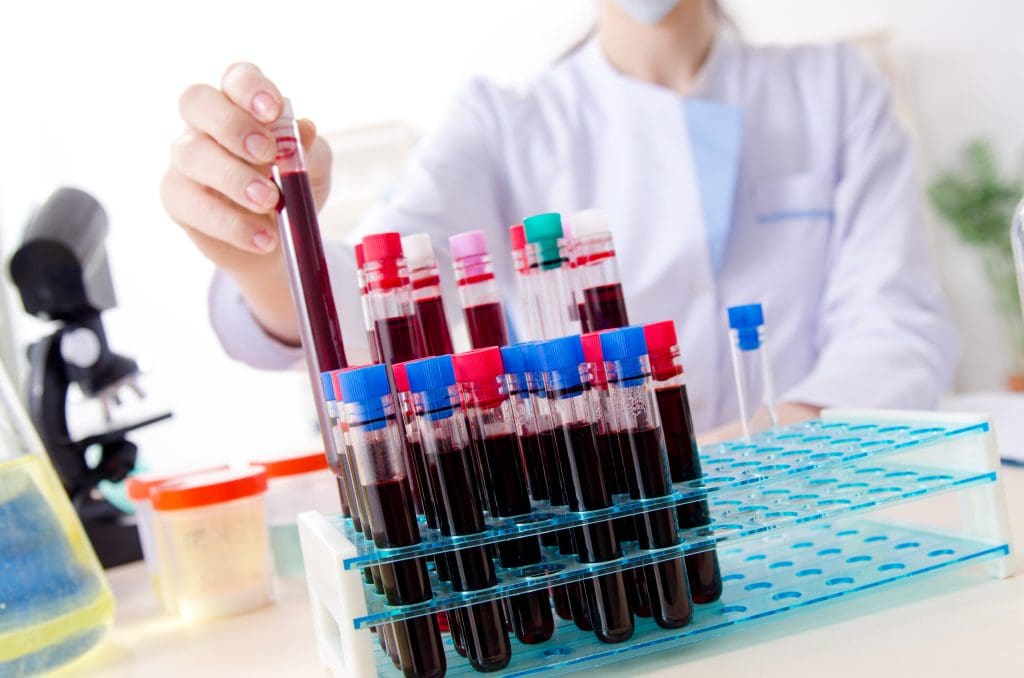 What are the top 10 blood diseases? 1 top 10 blood diseases