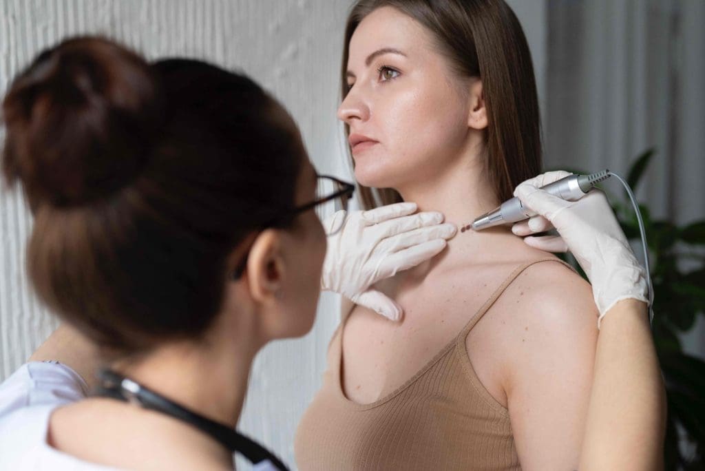 skin cancer excision procedure