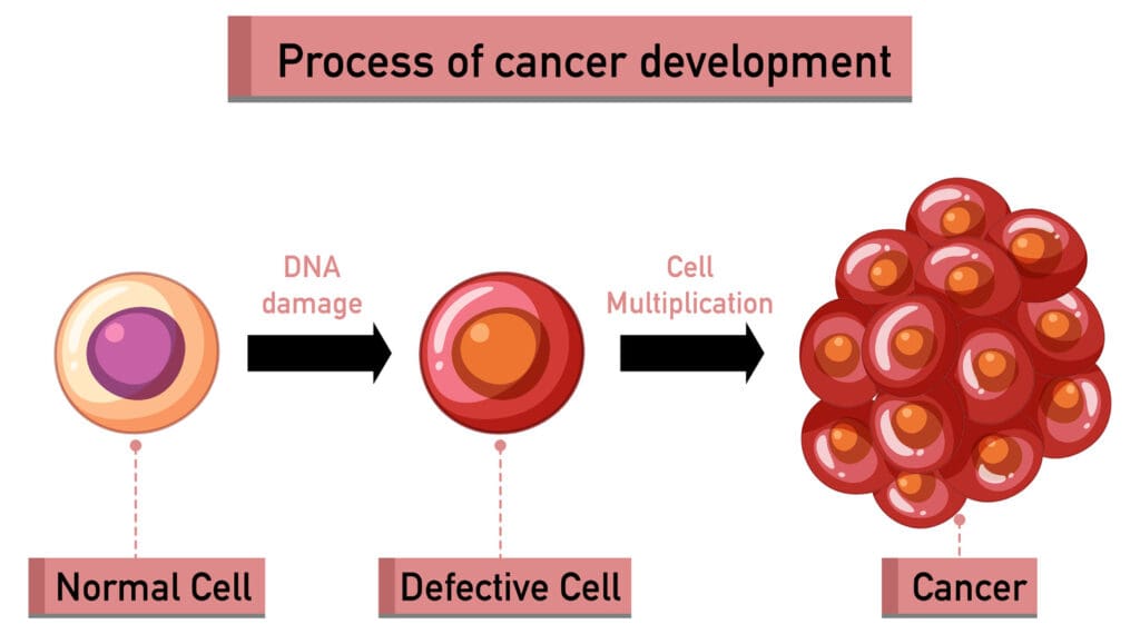 tumor development
