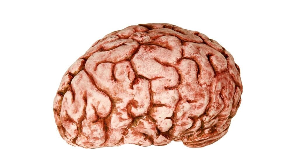 types of brain cysts