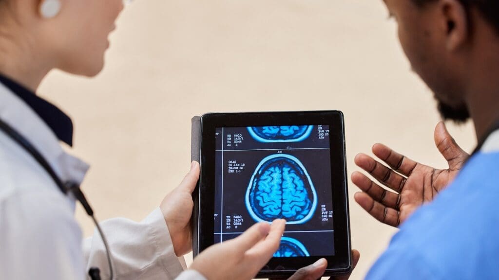 types of brain cysts