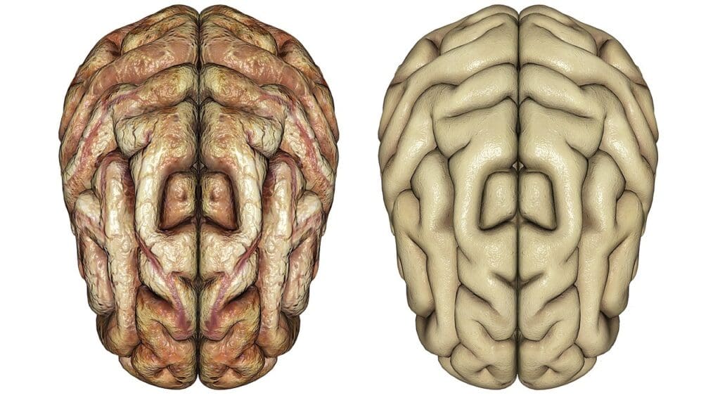 types of brain surgery