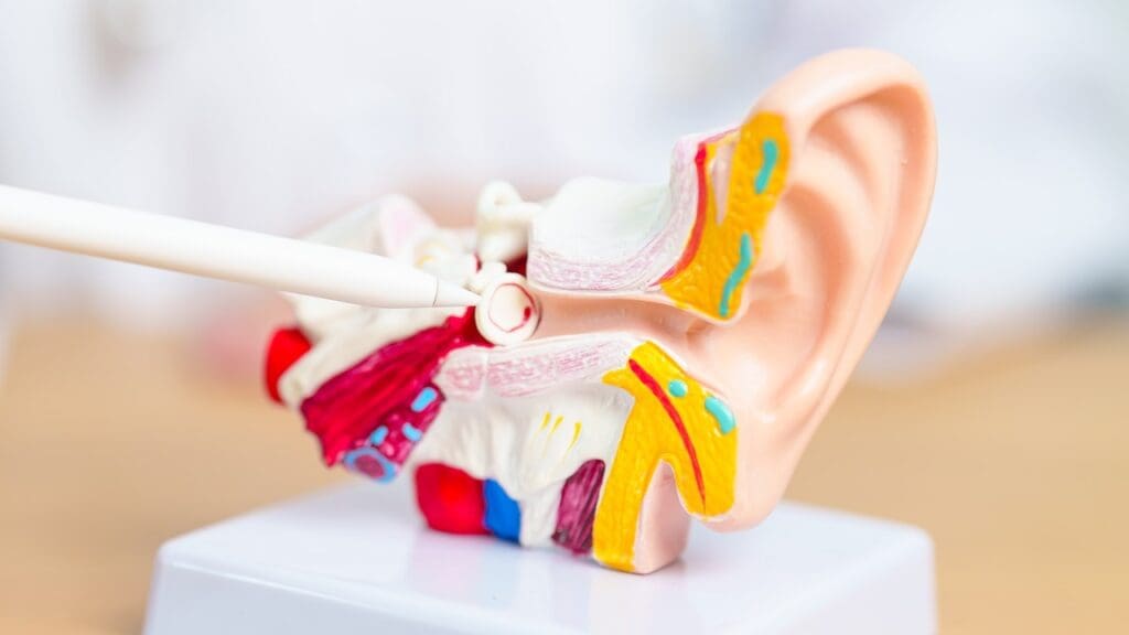 vestibular schwannoma
