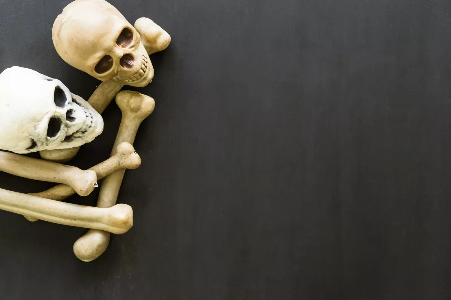 where does cadaver bone come from