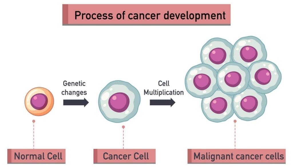 Malignant vs Benign Cancer: 8 Key Differences in Tumor Behavior 2 image 37 LIV Hospital